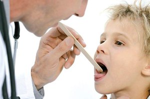 Çocuklarda stomatit nasıl tedavi edilir