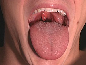 Oral mukoza tedavisi nasıl