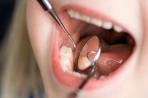 Durulama Listerine kullanımı için nedenler